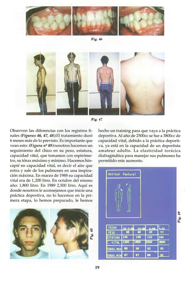 Dr. Guillermo F. Godoy Esteves - Por qu Ortopedia Funcional? - Pgina 19