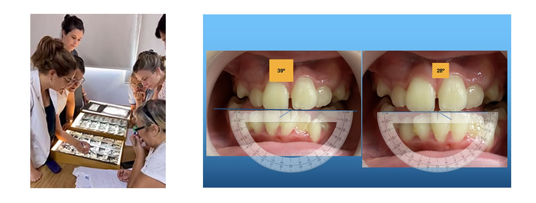 AMPLÍA TUS CONOCIMIENTOS Y RECURSOS TERAPÉUTICOS CON LA REHABILITACIÓN NEURO OCLUSAL - Dra. Maria del Carmen Attene, Dra. Silvana López y Dra. Alejandra Romanelli.